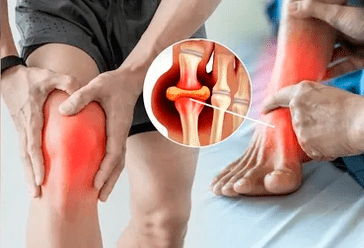 Schemat nakładania żelu Icexin na okolicę stawu kolanowego i stopy